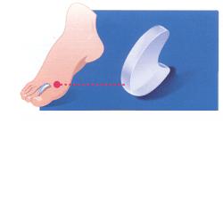 PODOGEL DIVARICATORE MISURA LARGE - Metafarm