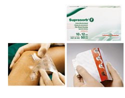 MEDICAZIONE STERILE IN FILM IN POLIURETANO TRASP. SUPRASORB F 10X12CM 10 PEZZI - Metafarm
